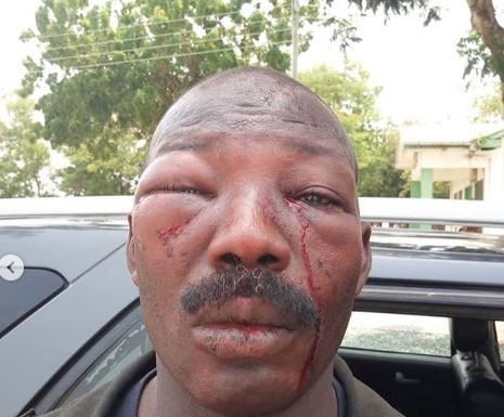 Angry residents at Amasaman brutally assault a Police officer