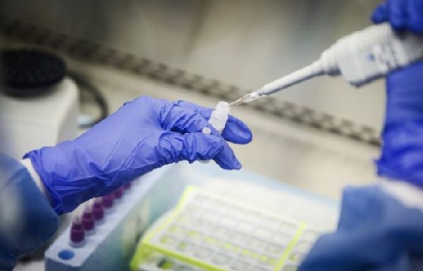 Ghana records 403 new cases of Coronavirus, tally now 2074