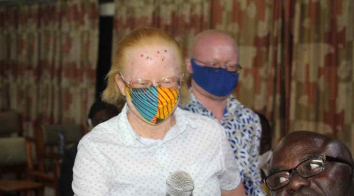 Albinos Appeal for Protection over Ritual Killings Ahead of 2020 Elections