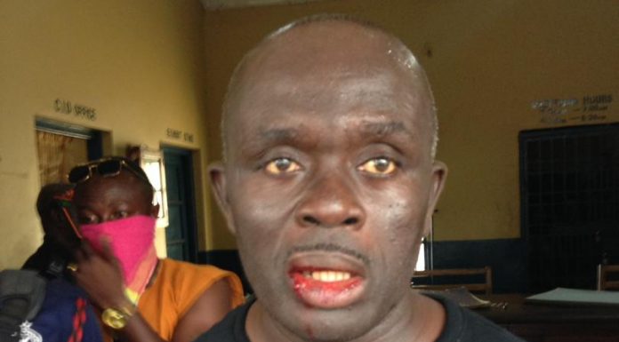 Lawyer Kwame Adom Appiah, MP Aspirant at Effiduase Asokore Constituency beaten for allegedly stealing electoral album