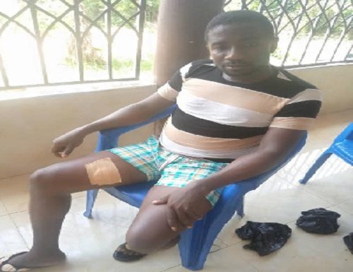Assemblyman sustains gunshot wounds in Highway robbery on Asankragwa-Kwabeng road