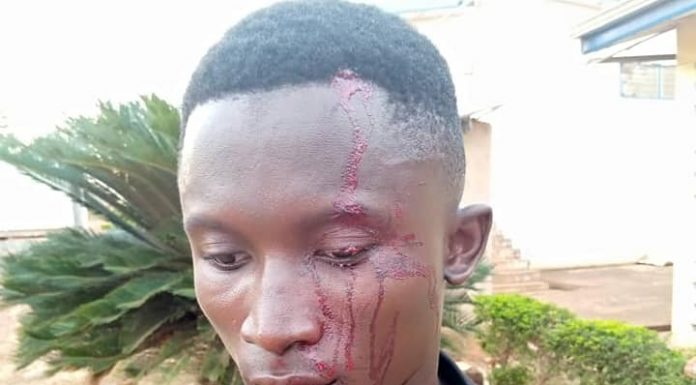 Angry Mob Attacks Police For Preventing Them From Killing Motor ‘Thief’