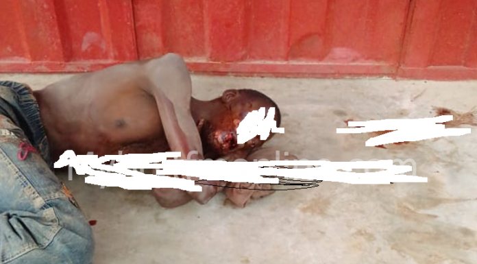 Man In Critical Condition After Unknown Men Cut Away His Tongue