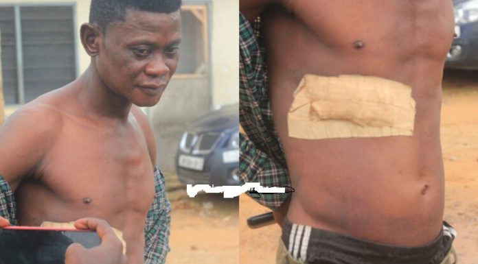 Armed robber shoots Effiakuma taxi driver, leaving him in bad condition
