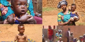 Disabled Baby Believed To Be Having Healing Ability After Series Of Like-Events.