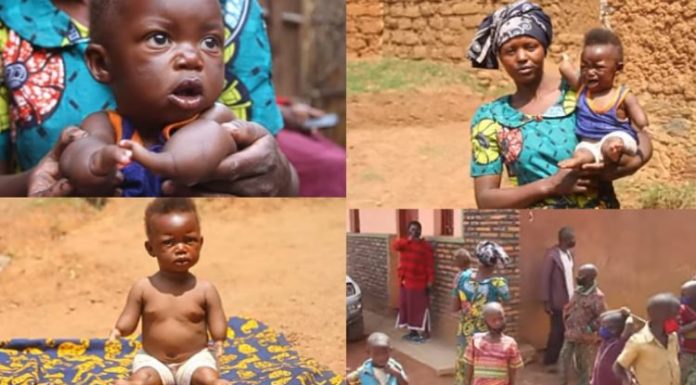 Disabled Baby Believed To Be Having Healing Ability After Series Of Like-Events.