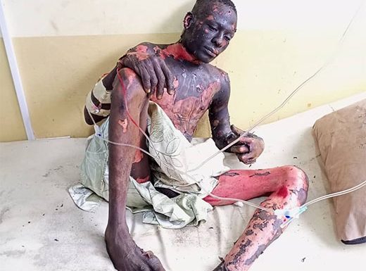 Electrocuted Cable Thief Dies