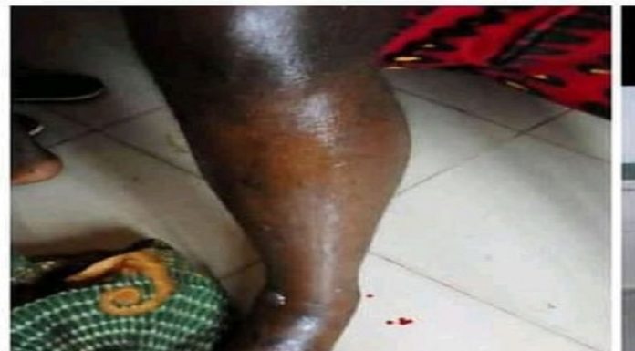 Snake bites Headteacher while easing himself at school farm